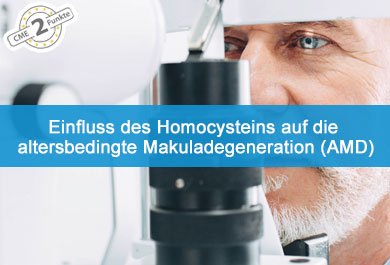 Einfluss des Homocysteins auf die altersbedingte Makuladegeneration (AMD)