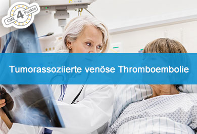 Tumorassoziierte venöse Thromboembolie