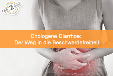 Chologene Diarrhoe: Der Weg in die Beschwerdefreiheit