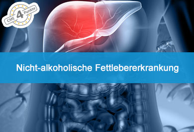 Nicht-alkoholische Fettlebererkrankung