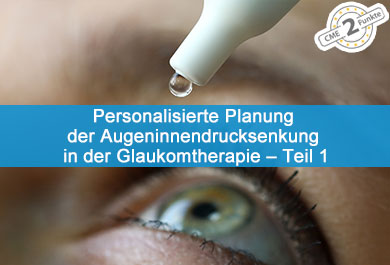 Personalisierte Planung der Augeninnendrucksenkung in der Glaukomtherapie – Teil 1