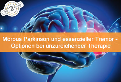 Morbus Parkinson und essenzieller Tremor - Optionen bei unzureichender medikamentöser Therapie