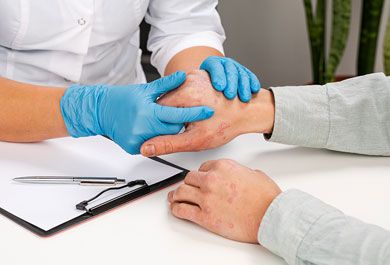 Aktuelles Management der atopischen Dermatitis