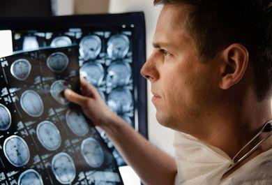 Detektion von Vorhofflimmern – Antikoagulation bei ESUS?