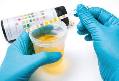 Harnwegsinfekte – von der Leitlinie in die Praxis