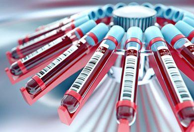 Hemmkörper bei Hämophilie A und B