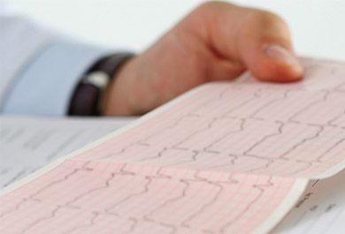 Interaktiver Fall: nicht valvuläres Vorhofflimmern, Diabetes und Niereninsuffizienz