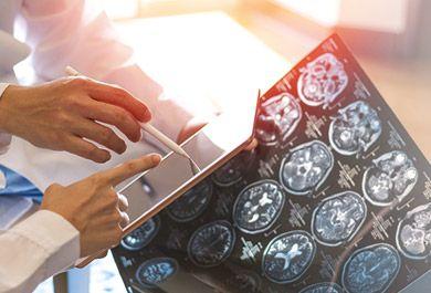 Kognitionsstörungen bei Multipler Sklerose