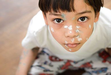 Update Herpes Zoster