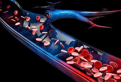 Venöse Thromboembolien bei onkologischen Patienten – Herausforderungen zwischen Leitlinien und klinischem Alltag