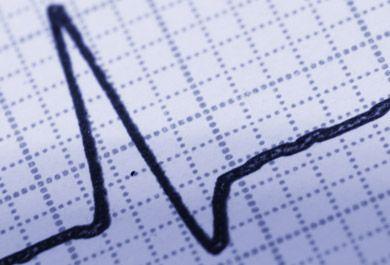 Vorhofflimmern diagnostizieren: Wann – Wer – Wie