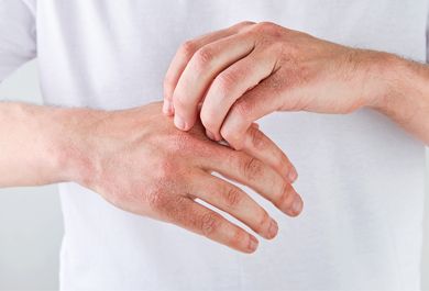 Chronisches Handekzem im Wandel: Herausforderungen, Therapieoptionen und aktuelle Innovationen