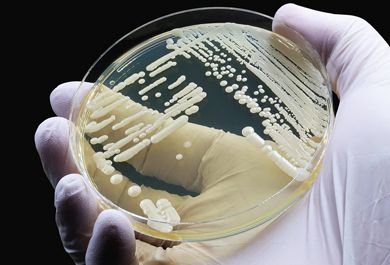 Der unkomplizierte Harnwegsinfekt – erfolgreiche Therapie und Prophylaxe