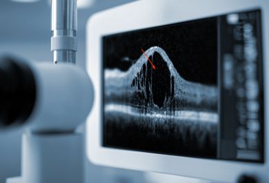 Diabetes und Auge – die Routine durchbrechen