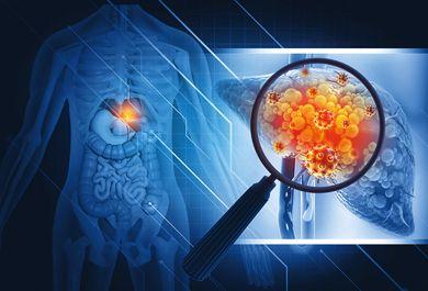 Fettlebererkrankungen richtig diagnostizieren