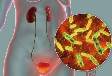 Harnwegsinfekte von unkompliziert bis rezidivierend