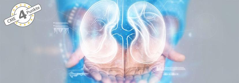 KDIGO-Leitlinien für die IgA-Nephropathie