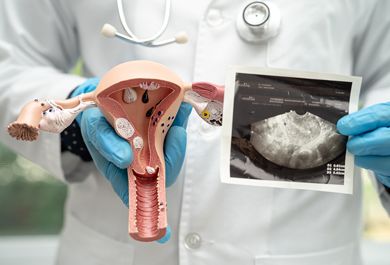 Neue medikamentöse Therapieoptionen in der Myombehandlung