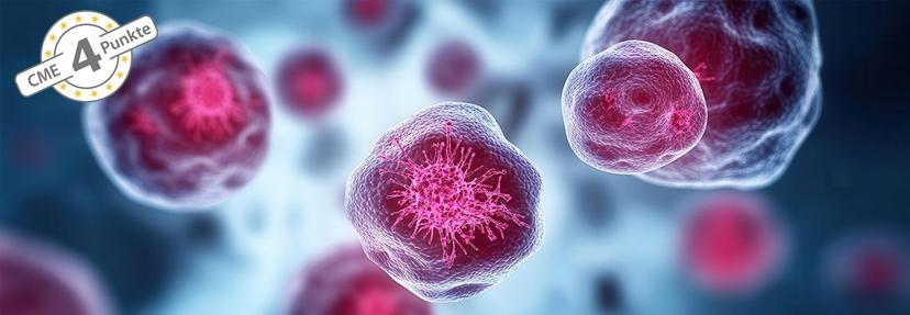 Neues zur personalisierten Therapie des Prostatakarzinoms