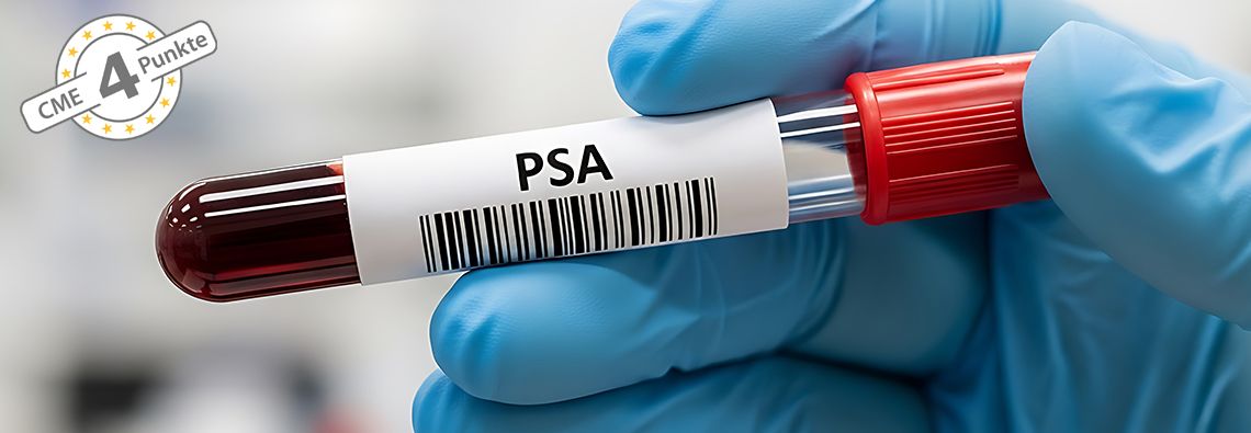 Prostatakarzinom: Aktuelle Daten zur Kombinationstherapie sowie Update zur S3-Leitlinie