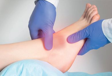 Sprunggelenkdistorsion: Diagnostik, Therapie und Rehabilitation in der Praxis