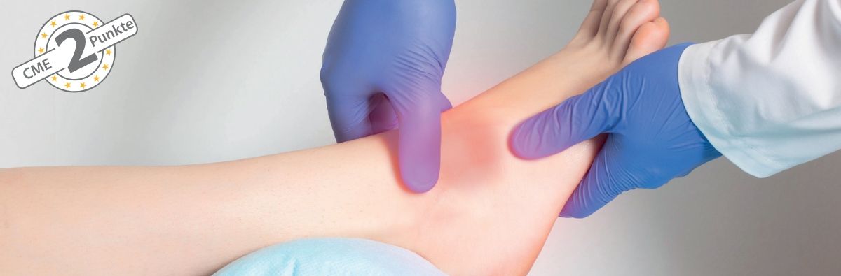 Sprunggelenkdistorsion: Diagnostik, Therapie und Rehabilitation in der Praxis