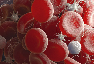 Antikoagulation-bei-tumorassoziierter-venöser-Thromboembolie-–-Hintergrund,-Studien-und-aktuelle-Evidenz
