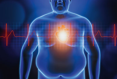 Bedeutung nicht LDL-senkender Therapieansätze bei kardiovaskulären Hochrisikopatienten mit erhöhten Triglyzeridwerten