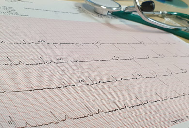 Effiziente-Gerinnungshemmung-bei-Diabetes-und-kardiovaskulären-Begleiterkrankungen