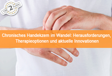 Chronisches Handekzem im Wandel: Herausforderungen, Therapieoptionen und aktuelle Innovationen 