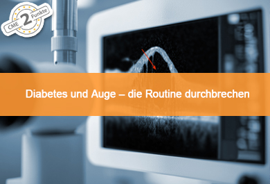 Diabetes und Auge – die Routine durchbrechen