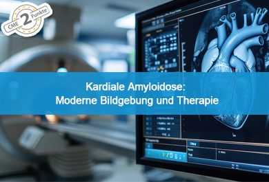 Kardiale Amyloidose: Moderne Bildgebung und Therapie