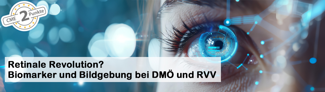 Retinale Revolution? Biomarker und Bildgebung bei DMÖ und RVV